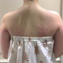 세븐일레븐 대전노은광장점 | [대전 유성 노은 피부, 체형 관리 맛집] 마블린에스떼 라운드 숄더 관리 솔직후기 전후비교, 거북목...