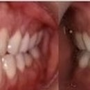 바른이교정치과기공소 이미지