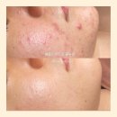 블랑드스킨 이미지