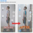 에이지웰 | [문정동 재활운동][송파 재활운동] 한 달 수업 후...불균형 개선! 에이지웰 재활운동센터 회원님의 변화