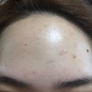 (주)지피엠 | +여름에 더워진 날씨로 인한 피부해결방법!