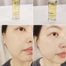 리리스 에스테틱 | 겨울철 극건조 피부 쟌피오베르 영양오일세럼으로 촉촉하게 셀프케어