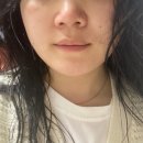 서우메디 | [기미크림] 라온메디 멜라스마 케어 크림 (LAONMEDI MELASMA CARE CREAM) 2주 사용 후기