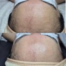 군자 피부관리 에스테틱 오우시아에서 민감한 피부도 가능한 플라토닝 에끌라 받고온 후기