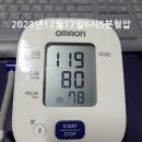 ‘젊은 뇌졸중’ 발병 나이 43.6세에서 42.9세로 낮아지는데… 이미지