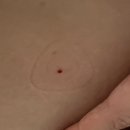 송도 마운자로 위고비 처방 가격 | 리더스 성형외과 | 성지 정보 한달차 다이어트 후기