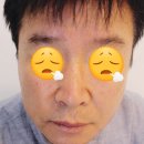 [대구] 수성구 피부관리 잘하는 곳 재방문 후기!