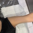 강남브이에스(VS)라인의원 | 강남브이에스(VS)라인의원 팔뚝 온다