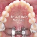 스타치과기공소 이미지