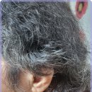 행복히어링 이미지