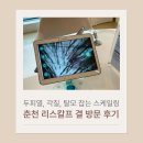 리스칼프 | 춘천 서면두피관리 받고 열감과 각질 완화된 후기 – 리스칼프 결