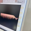 광주플라즈마 제이샵뷰티 후기