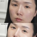 잡티세럼 리뉴얼 아이소이 올영세일 탄피부 복구 후기 올리브영 에센스