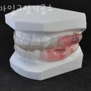 스마일교정치과기공소 이미지