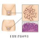 Re : 곤 두 博 膣 이미지