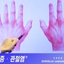종부테라피 이미지
