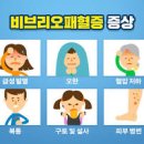 비브리오 패혈증 장염 식중독 증상 비브리오균 예방하기 이미지