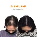 고양 두피문신 일산 두피문신 서울근교 두피문신 smp 시술 리얼 후기!!