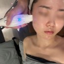 대구 달서구 상인동피부관리 써마지 정온에스테틱 후기