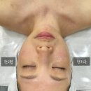 안현로서8길 | 룩서스 소프트 플라즈마 후기 평택 지니에스테틱✨ 원장님의 손맛+성격까지 완벽했던 하루💖