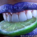 에버스마일치과교정과치과의원 네이버블로그