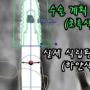 연세원드림치과의원 네이버블로그