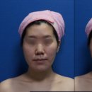 아름턱한의원 이미지