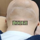 (주)아그네스메디컬 | 여의도피부과전문의 이중턱치료 아그네스 생생시술기