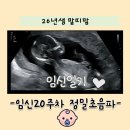W 인천심장동물병원 | 인천 w여성병원 임신 20주 차 정밀 초음파 후기 l 아기 뇌 발달 확인+성별 확정+총비용
