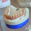 현대웰치과의원 | 임플란트 고민 끝판왕 발견! 프라임 39 프 란 트 치과의원 썰 푼다