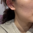 피부관리 성산동 상암동 피부관리 에너지테라피 리프팅 수분관리 웨딩케어 명가 이모아에스테틱 솔직후기