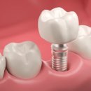 향남바른치과의원 이미지