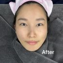 은삼성성형외과 네이버블로그