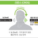 참소리보청기