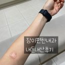 장이편한내과의원 네이버블로그