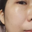 피부과 화장품 리쥬페어 타입쓰리 리제너레이션 탄력크림 사용 후기