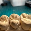 설 치과기공소 이미지