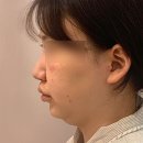 투턱 이미지