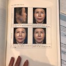 향기고운 | [부산웨딩케어] 센텀 피부관리 고운빛깔 온다 웨이브 리프팅 효과 후기