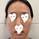 진성한의원 | 역삼피부과 속건조, 피부톤 시술 캐비어리빌더 어붐야그레이저 받은 내돈내산후기