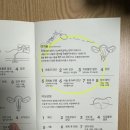 교대역, 최상산부인과 난소 낭종 경화술 후기