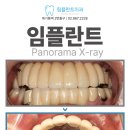 림플란트치과의원 네이버블로그