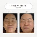 리라 에스테틱 | 성서 신부관리 <리라 에스테틱> 내돈내산 후기(+림프순환)