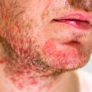 운양한의원 이미지