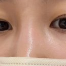 눈뷰티크 이미지