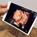 이장현산부인과의원 이미지