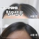 환절기 두피관리 두랩스교보 파머셀 엑소딘 탈모샴푸 사용후기