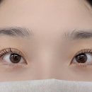 아이플로아