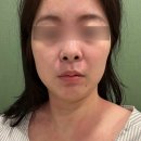 웰니스케어 | [군산] 에스테틱 피부 다이어트 관리샵 웰니스 리셋 케어 후기 하이퍼소닉