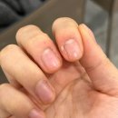 강남우태하피부과의원 이미지